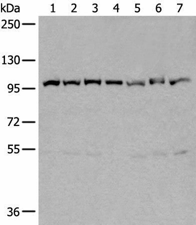 VCP Polyclonal Antibody – Figure 1 of 4
