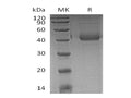 Recombinant Human SFTPD/SP-D Protein (Glu22Gly, His Tag) – Figure 1 of 2