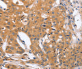 BLNK Polyclonal Antibody – Figure 1 of 3