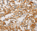 ART3 Polyclonal Antibody – Figure 1 of 3