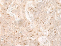 IL7 Polyclonal Antibody – Figure 1 of 3
