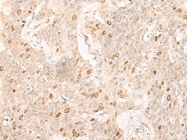 IL7 Polyclonal Antibody – Figure 1 of 3
