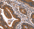 HACE1 Polyclonal Antibody – Figure 1 of 3