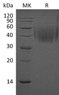 Recombinant Mouse 2B4/CD244 Protein (His Tag) – Figure 1 of 2