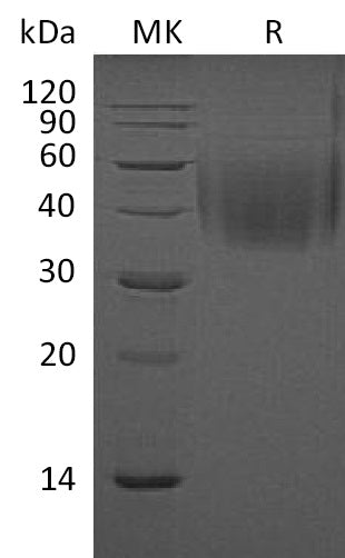 Recombinant Mouse 2B4/CD244 Protein (His Tag) – Figure 1 of 2