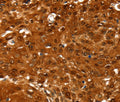 NCOR1 Polyclonal Antibody – Figure 1 of 3