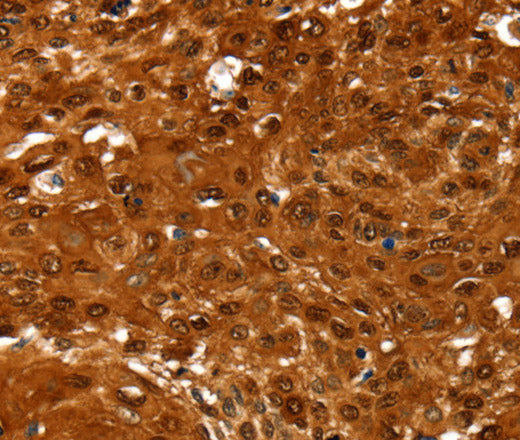NCOR1 Polyclonal Antibody – Figure 1 of 3