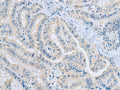 MSI2 Polyclonal Antibody – Figure 1 of 3