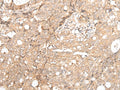 FOXO4 Polyclonal Antibody – Figure 1 of 3