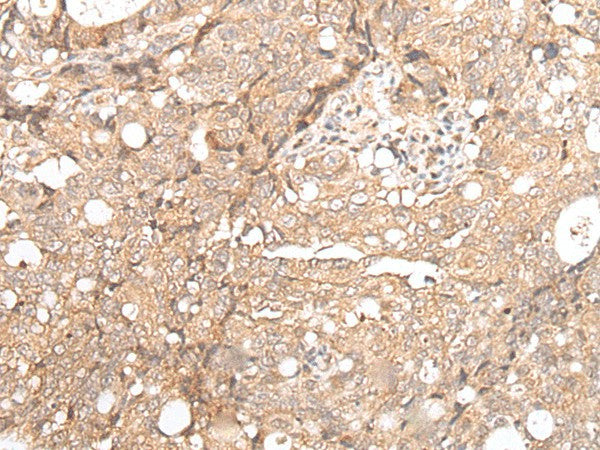 FOXO4 Polyclonal Antibody – Figure 1 of 3