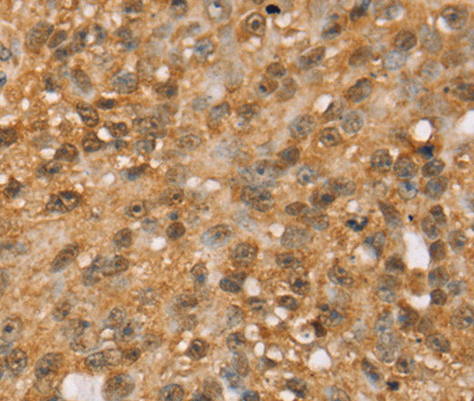 MED22 Polyclonal Antibody – Figure 1 of 2