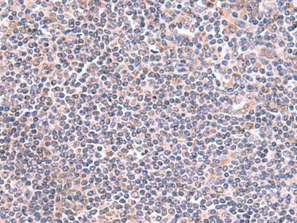 GMDS Polyclonal Antibody – Figure 1 of 3