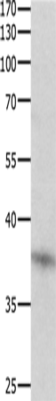 DUSP12 Polyclonal Antibody – Figure 1 of 2
