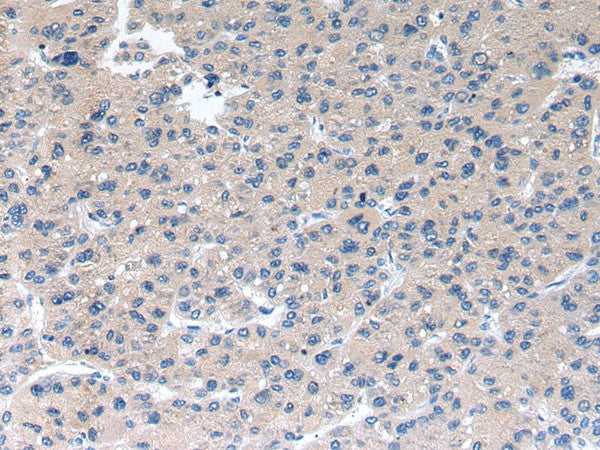 RAB2A Polyclonal Antibody – Figure 1 of 3