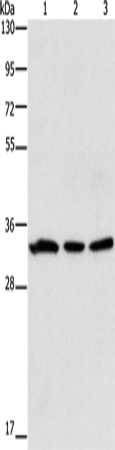 GPA33 Polyclonal Antibody – Figure 1 of 4