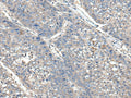 XDH Polyclonal Antibody – Figure 1 of 2
