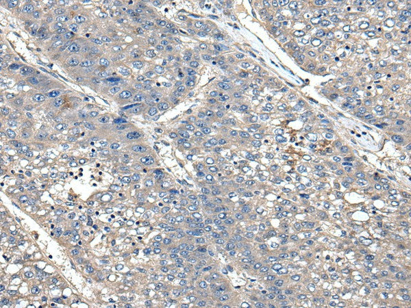 XDH Polyclonal Antibody – Figure 1 of 2