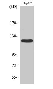 FAK Polyclonal Antibody – Figure 1 of 2