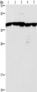 GNA13 Polyclonal Antibody – Figure 1 of 4