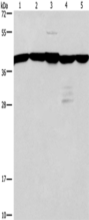 GNA13 Polyclonal Antibody – Figure 1 of 4