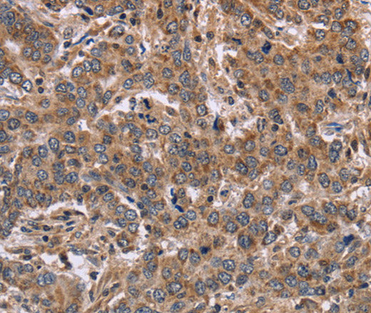 FAAH2 Polyclonal Antibody – Figure 1 of 3