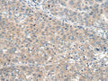 SEMA4D Polyclonal Antibody – Figure 1 of 2