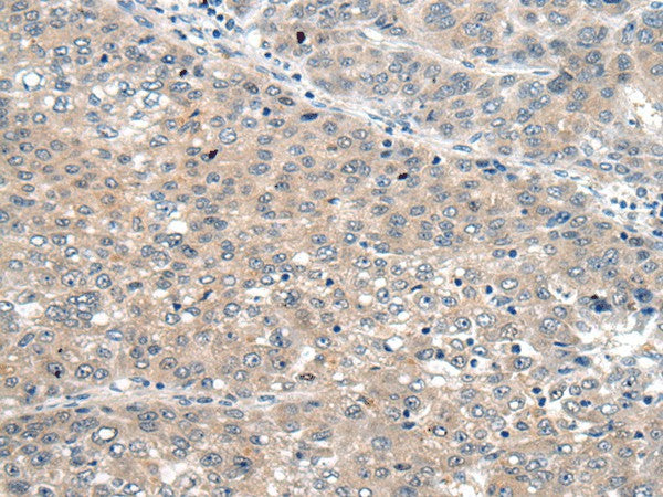 SEMA4D Polyclonal Antibody – Figure 1 of 2