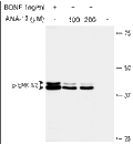 ANA-12 – Figure 1 of 2