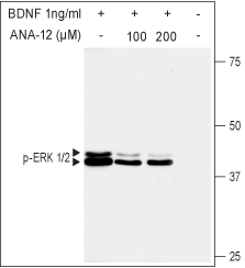 ANA-12 – Figure 1 of 2
