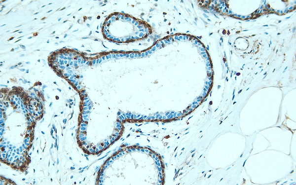 Anti-Annexin A1 – Figure 1 of 2