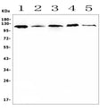 Anti-HIF-1 alpha/HIF1A Antibody Picoband®