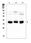 Anti-CXCR4 Antibody Picoband®