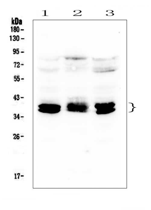 Anti-CXCR4 Antibody Picoband®