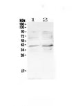 Anti-CCR5 Antibody Picoband®