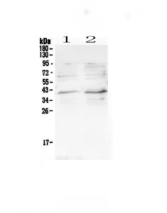 Anti-CCR5 Antibody Picoband®