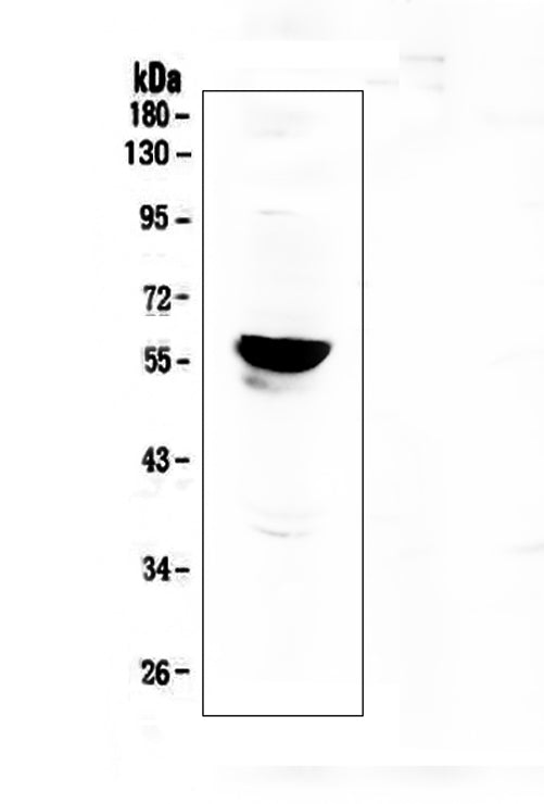 Anti-Aromatase/CYP19A1 Antibody Picoband®