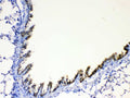 Anti-AGRP Antibody