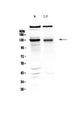 Anti-BMPR2 Antibody Picoband®