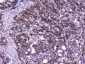 Anti-CIC Antibody