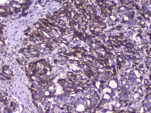 Anti-CIC Antibody
