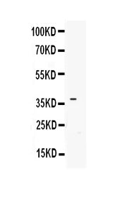 Anti-IGFBP3 Antibody Picoband®