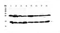 Anti-Galectin 1/Lgals1 Antibody Picoband®