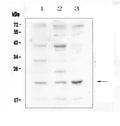 Anti-Leptin Antibody Picoband®