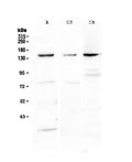 Anti-VEGF Receptor 1/FLT1 Antibody Picoband®