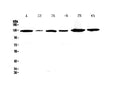 Anti-VEGF Receptor 1/FLT1 Antibody Picoband®