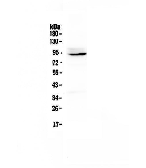 Anti-PTPN22 Antibody Picoband®