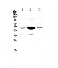 Anti-PAI1/Serpine1 Antibody Picoband®