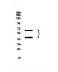 Anti-TIM 3/HAVCR2 Antibody Picoband®
