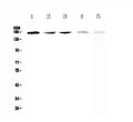 Anti-IRE1/ERN1 Antibody Picoband®