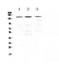Anti-TrkA/NTRK1 Antibody Picoband®